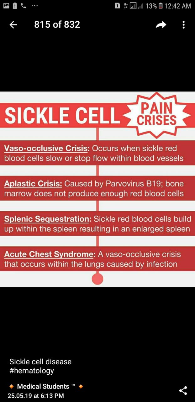 Sickle cell anaemia-455028586_421526.jpg